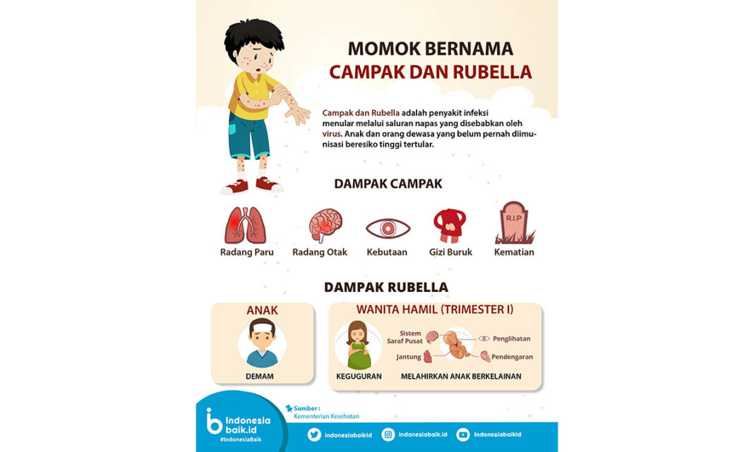 Penanganan Penyebaran KLB Campak, 9.825 Vaksin MR Disalurkan ke Sumenep