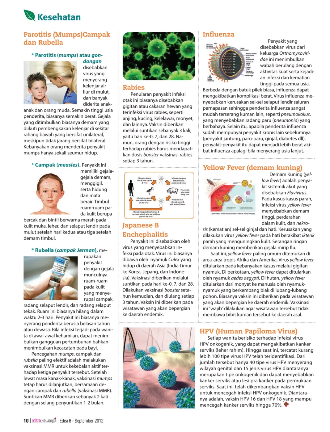 Gejala Campak Diawali Flu Biasa Diikuti Panas Tinggi